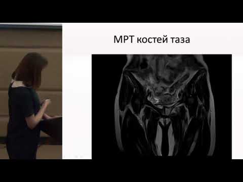 Видео: Круглова М.В. Случай системной красной волчанки с трагическим исходом | Системная красная волчанка