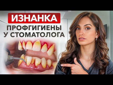 Видео: Идешь на гигиену полости рта? СТОП – сначала посмотри это видео / Как проходит процедура ОТ и ДО