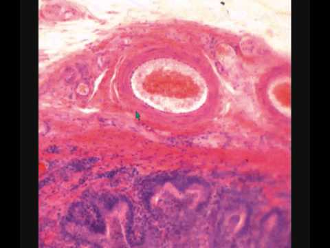 Видео: ПРЕДСТАТЕЛЬНАЯ ЖЕЛЕЗА  ПРОСТАТА  гистологическое строение  PROSTATE