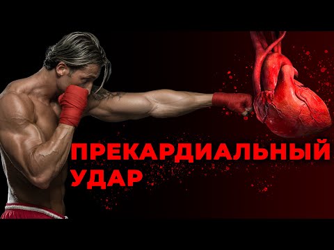 Видео: Прекардиальный удар. За и против.  #ПроСМП
