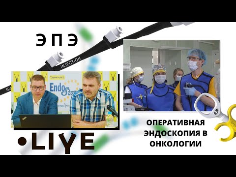 Видео: Эндоскопическая папиллэктомия. Прямая трансляция "Оперативная эндоскопия в онкологии"
