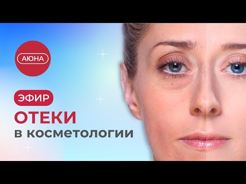 Видео: Как убрать отёки на лице | Причины отёчности, методы и возможности косметологии