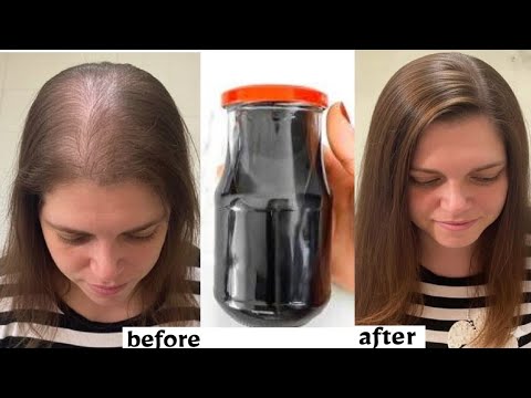 Видео: Распыляйте его на волосы всего два дня, и ваши волосы начнут расти в 3 раза быстрее.