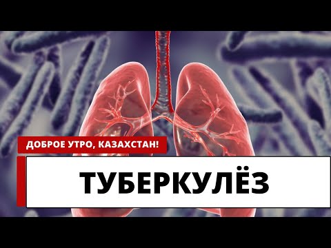 Видео: ТУБЕРКУЛЁЗ: ЧТО НУЖНО ЗНАТЬ О ЛИЧНОЙ БЕЗОПАСНОСТИ