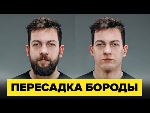 Видео: Пересадка бороды: Все, что вам нужно знать