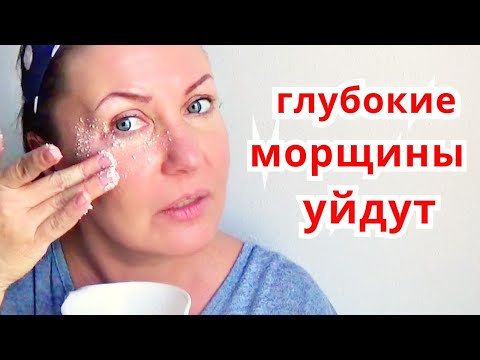 Видео: КОЖА ВОКРУГ ГЛАЗ МОЛОДЕЕТ СРАЗУ / МАСКА ОТ ГЛУБОКИХ МОРЩИН из РИСА Натуральный рецепт
