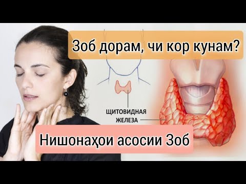 Видео: Гормонхои гадуди сипаршакл. Хомиладори бо Зоб. Тарзи табобат #зоб #хомиладори #табобат