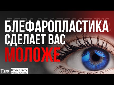 Видео: Блефаропластика - Игорь Романов — Пластический и челюстно-лицевой хирург