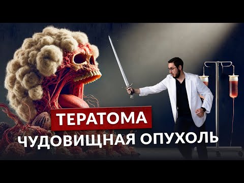 Видео: Дермоидная киста - почему в яичнике растут зубы и волосы?