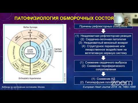 Видео: Обмороки: дифференциальный диагноз