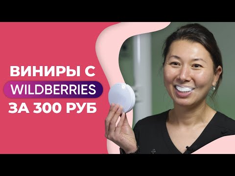 Видео: Виниры за 300 рублей!? / Как сделать красивую улыбку за 2 минуты?