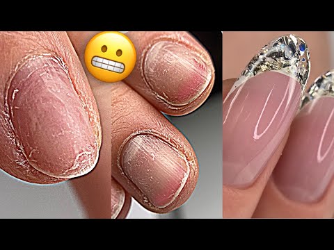 Видео: Коррекция ногтей после салона 😱 Истончили ногтевую пластину💅 Хрустальный френч