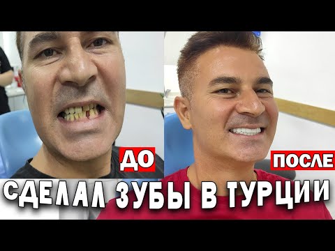 Видео: УРА! БОЛЬШЕ НЕ БОЛЕЮ! СДЕЛАЛ ЗУБЫ В ТУРЦИИ \ Цены на стоматологию \ Кепез Анталия