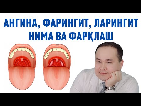 Видео: АНГИНА, ФАРИНГИТ, ЛАРИНГИТ БУЛАРНИ ФАРҚИ НИМА ВА БЕЛГИЛАРИНИ АЖРАТИШ ҲАҚИДА ДОКТОР ИСЧАНОВ