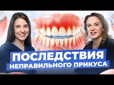 Видео: Неправильный прикус — последствия неизбежны. Не игнорируй это!