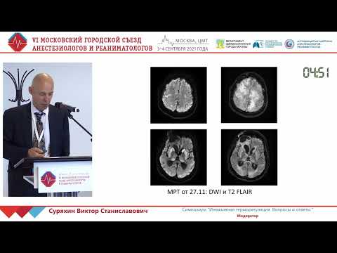 Видео: Управление температурой в нейро ОРИТ Савин И.А.