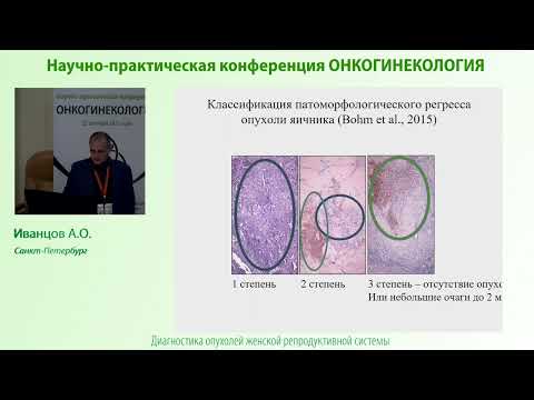 Видео: Морфологическая оценка ответа рака яичников на неоадьювантную химиотерапию