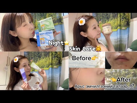 Видео: Арьснаасаа болж Stress-дэж байгаа бүх хүмүүст🥹 | Night Skin Care ⭐️ (эмзэг арьс,арьсны эмчилгээ..)