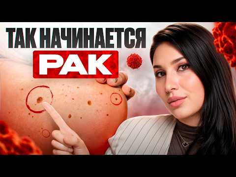 Видео: Как не пропустить РАК НА 1 СТАДИИ: симптомы, которые ИГНОРИРУЮТ ВСЕ!