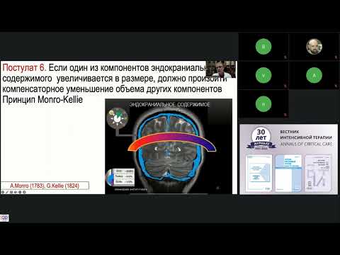 Видео: Андрей Белкин: острая церебральная недостаточность - опыт 20-летнего осознания / journal_vit