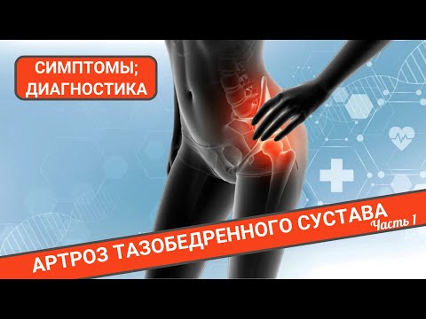 Видео: АРТРОЗ ТАЗОБЕДРЕННОГО СУСТАВА. СИМПТОМЫ И ДИАГНОСТИКА. (Часть 1)