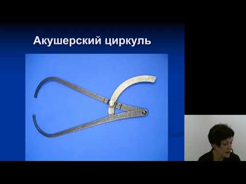 Видео: Акушерство. Узкий таз в современном акушерстве