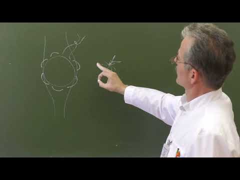 Видео: Пластика по Лексеру при пупочных грыжах