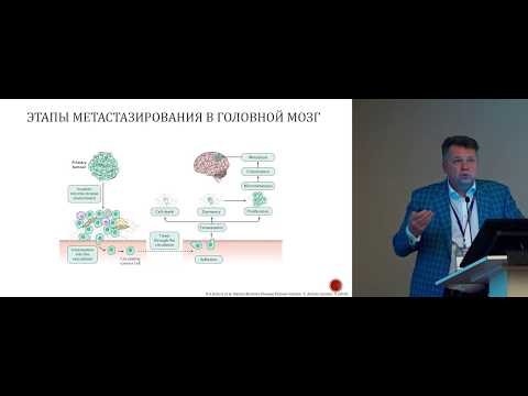 Видео: Возможности иммунотерапии по контролю метастатического поражения головного мозга