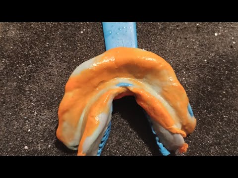 Видео: ПРОТЕЗГЕ ҚАЛЫП ШАБЛОН ДАЙЫНДАУ 