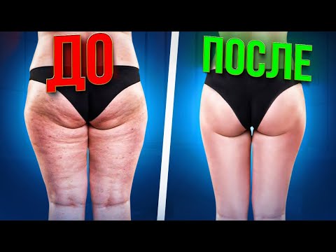 Видео: УБИРАЕМ ЛЯЖКИ | Только ЛУЧШИЕ упражнения на внутреннюю часть бедра для похудения ног