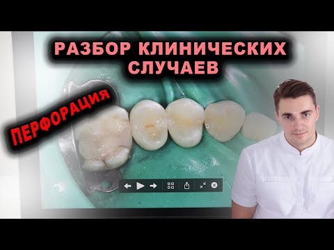 Видео: Индивидуальный курс. Разбор клинических случаев