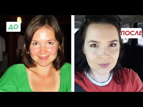 Видео: Как НАВСЕГДА избавиться от ЖИРНОГО БЛЕСКА на лице и в Т-зоне