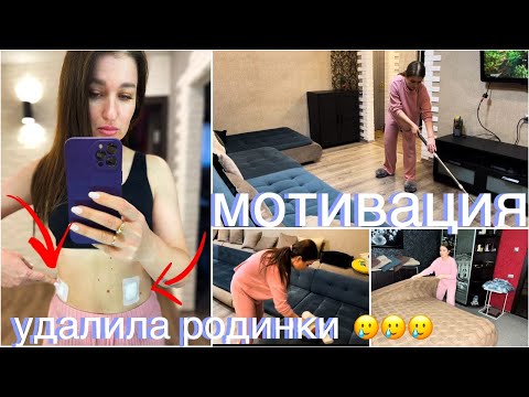 Видео: УДАЛЕНИЕ РОДИНОК/ МОТИВАЦИЯ НА УБОРКУ/ СМЕШНАЯ ИСТОРИЯ #мотивация