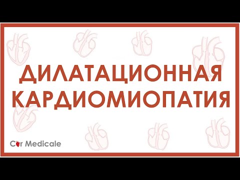 Видео: Дилатационная кардиомиопатия - причины, механизмы, симптомы, последствия