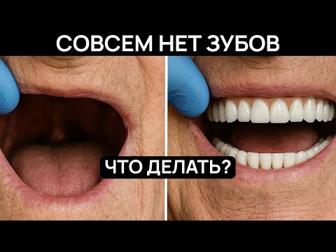 Видео: Что делать, если вообще нет зубов. Способ восстановить все зубы за 7 часов