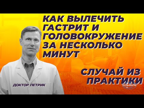 Видео: Как вылечить гастрит и головокружение за несколько минут. Пример из практики