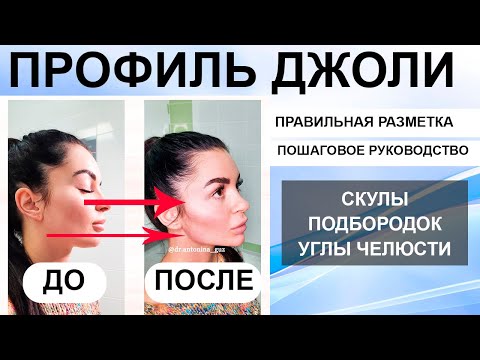 Видео: ПРОФИЛЬ ДЖОЛИ: скулы, подбородок, углы челюсти