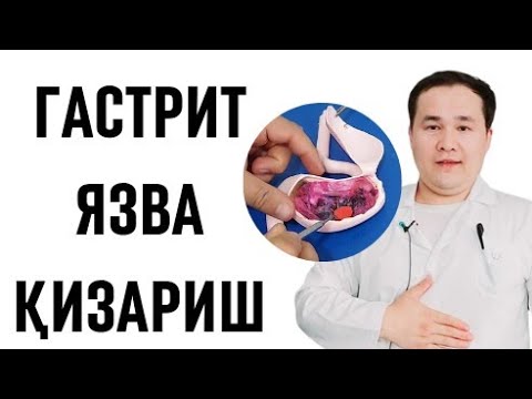 Видео: ОШҚОЗОН ИЧАК КАСАЛЛИКЛАРИ УЙ ШАРОИТИДА ДАВО ЧОРАЛАРИ / ГАСТРИТ, ЯЗВА, ҚИЗАРИШ ДОРИЛАРИ