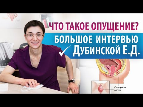 Видео: Опущение органов малого таза. Симптомы, группа риска и методы лечения. Интервью с Дубинской Е.Д.