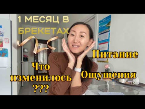 Видео: 1 МЕСЯЦ В БРЕКЕТАХ🎉//ЧТО ИЗМЕНИЛОСЬ???//ОЩУЩЕНИЯ🤨//ПИТАНИЕ🍲