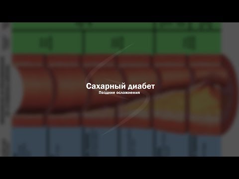 Видео: Сахарный диабет. Поздние осложнения