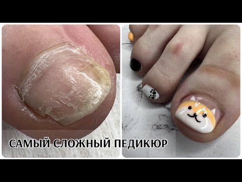 Видео: САМЫЙ СЛОЖНЫЙ ПЕДИКЮР ЗА ВСЕ ВРЕМЯ🥺долгая работа с РИСОВАШКАМИ🤪Лиса или собака⁉️