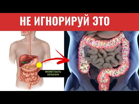 Видео: СКРЫТАЯ Информация , Которую Показывает ВАШ СТУЛ. Изменения Стула При Онкологии.