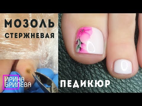 Видео: СТЕРЖНЕВАЯ МОЗОЛЬ эстетический педикюр 🌸 ПЕДИКЮР акварель 🌸 Ирина Брилёва