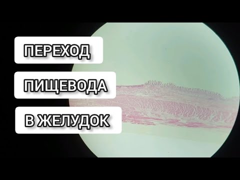 Видео: Переход пищевода в желудок