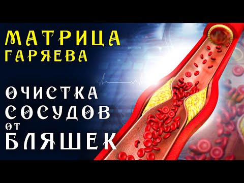 Видео: Матрица Гаряева Мощная Очистка Сосудов от Холестериновых Бляшек ☀️ Квантовое Очищение Сосудов Звуком