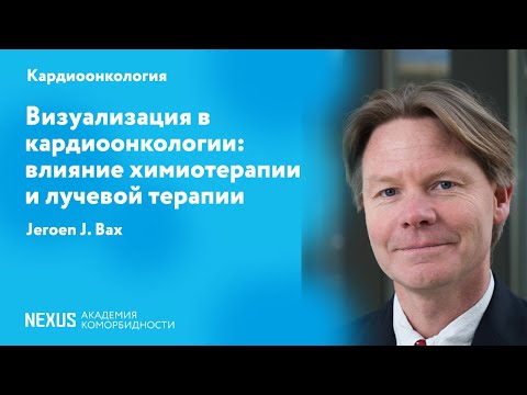 Видео: Визуализация в кардиоонкологии: влияние химиотерапии и лучевой терапии