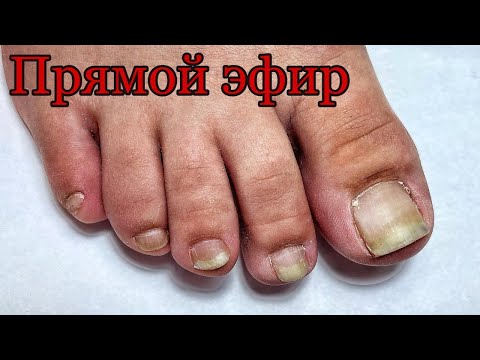 Видео: ПЕДИКЮР ОНЛАЙН. МОЗОЛИ. Виктория Авдеева