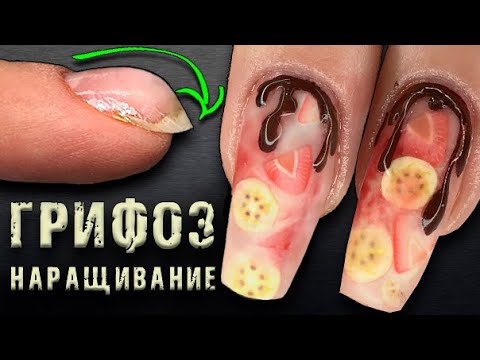 Видео: ГРИФОЗ Ногтей.😱Гель с НАЧИНКОЙ!🍌ТРЕШ-МАНИЮР.Преображение СКРУЧЕНЫХ Ногтей.Урок КАК НАРАСТИТЬ НОГТИ