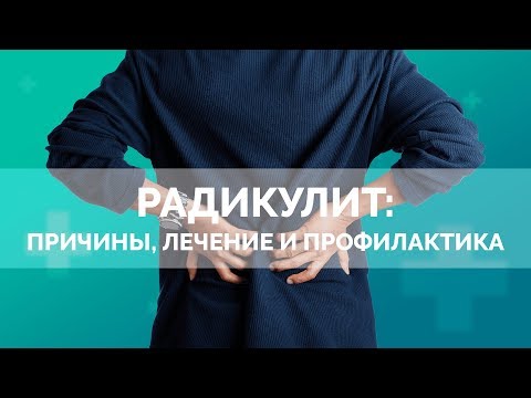 Видео: Радикулит: причины, лечение и профилактика